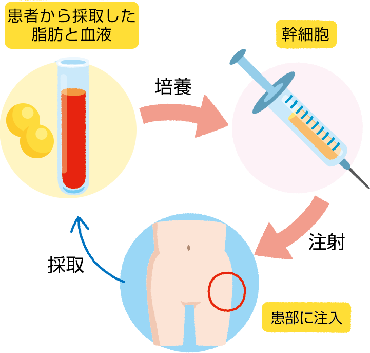 自体干细胞的培养时间